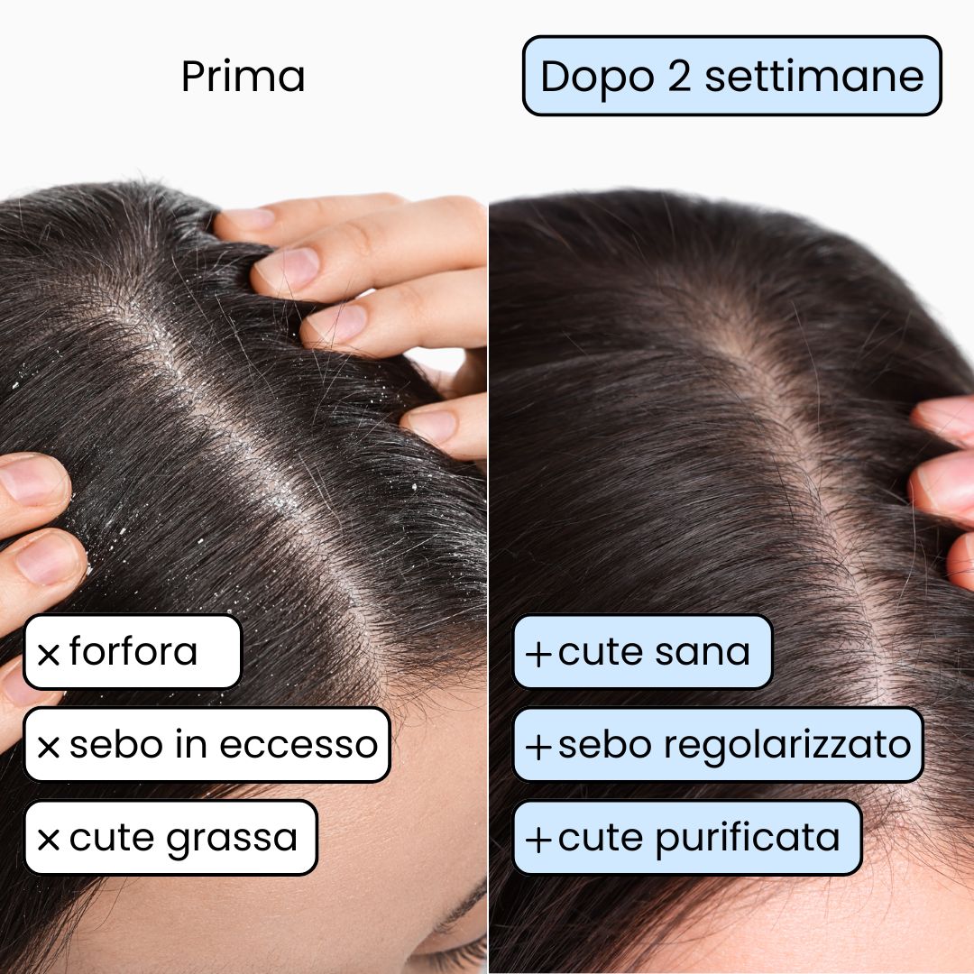 Shampoo Solido Purificante per capelli Grassi x2